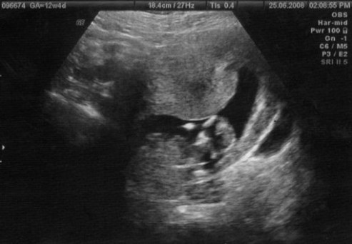 10399258_54694385513_2748_n (2)